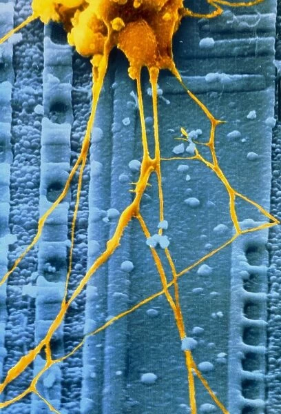 SEM of human nerve cells