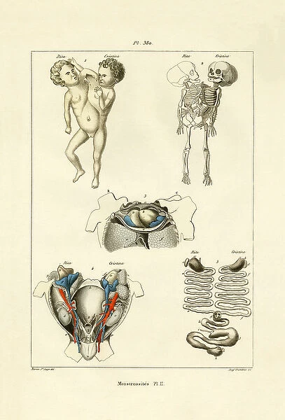 Freak, 1833-39 (coloured engraving)