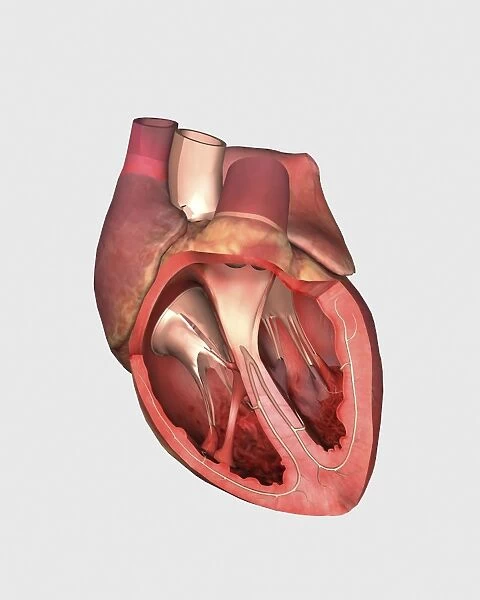 Heart valves showing pulmonary valve, mitral valve and tricuspid